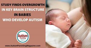 Estudio encuentra sobrecrecimiento en estructura cerebral clave en bebés que desarrollan autismo https://www.autismparentingmagazine.com/brain-structure-autism-babies/