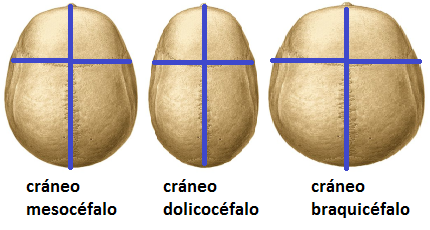 Cráneo mesocéfalo, dolicocéfalo y braquicéfalo.