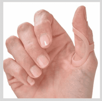 La historia de las ferulas para dedos Oval 8 originales