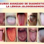 diagnostico de la lengua hacia l