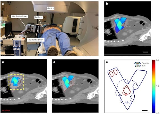 Nueva tecnologia visualiza dosis de radioterapia en tiempo real