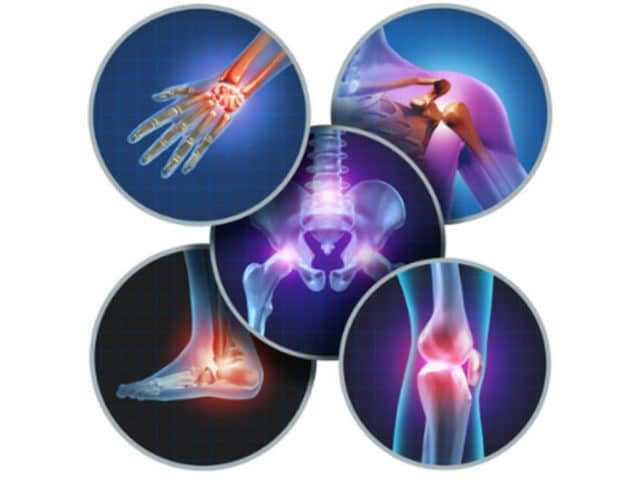 Manejo de multiples tipos de artritis