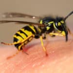 Bee Sting Treatment and Prevention – Cleveland Clinic